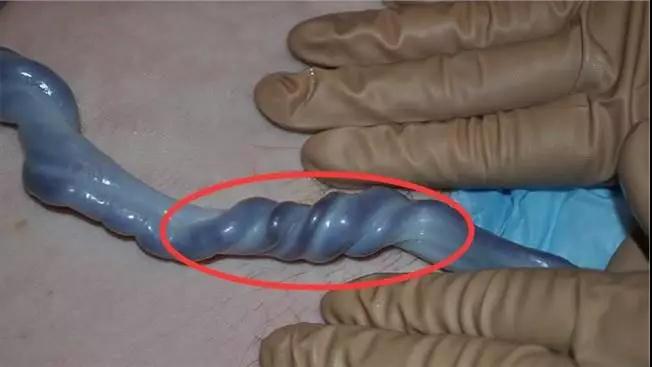 孕妇发现胎儿不对劲怎么办,发现胎儿不怎么动了怎么办