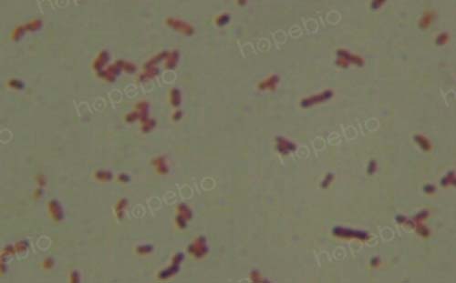 大肠埃希菌培养,大肠埃希菌70%正常吗