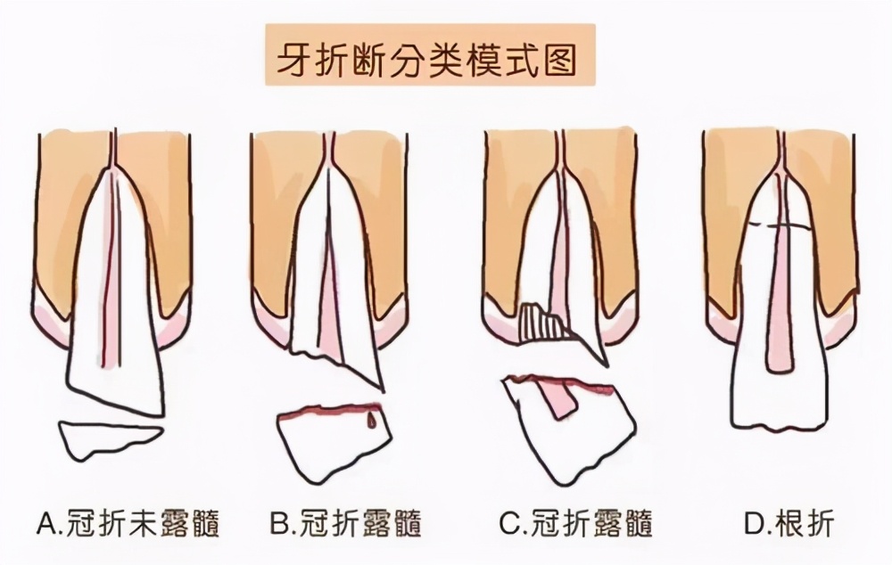 牙痛不是病痛起来要命,牙痛不是病痛起来要命漫画