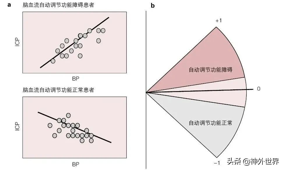 日本脑卒中康复治疗指南,脑室引流与颅内压监测技术