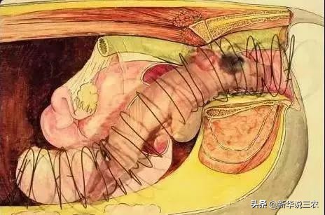 接产要领及接产步骤,助产催产方法