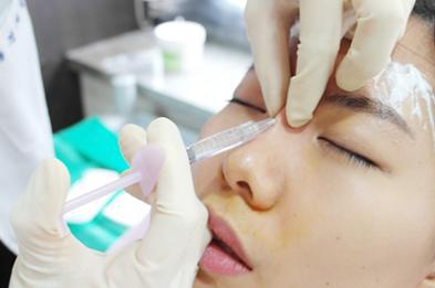 打一针玻尿酸隆鼻有没有危害,20岁姑娘打玻尿酸隆鼻