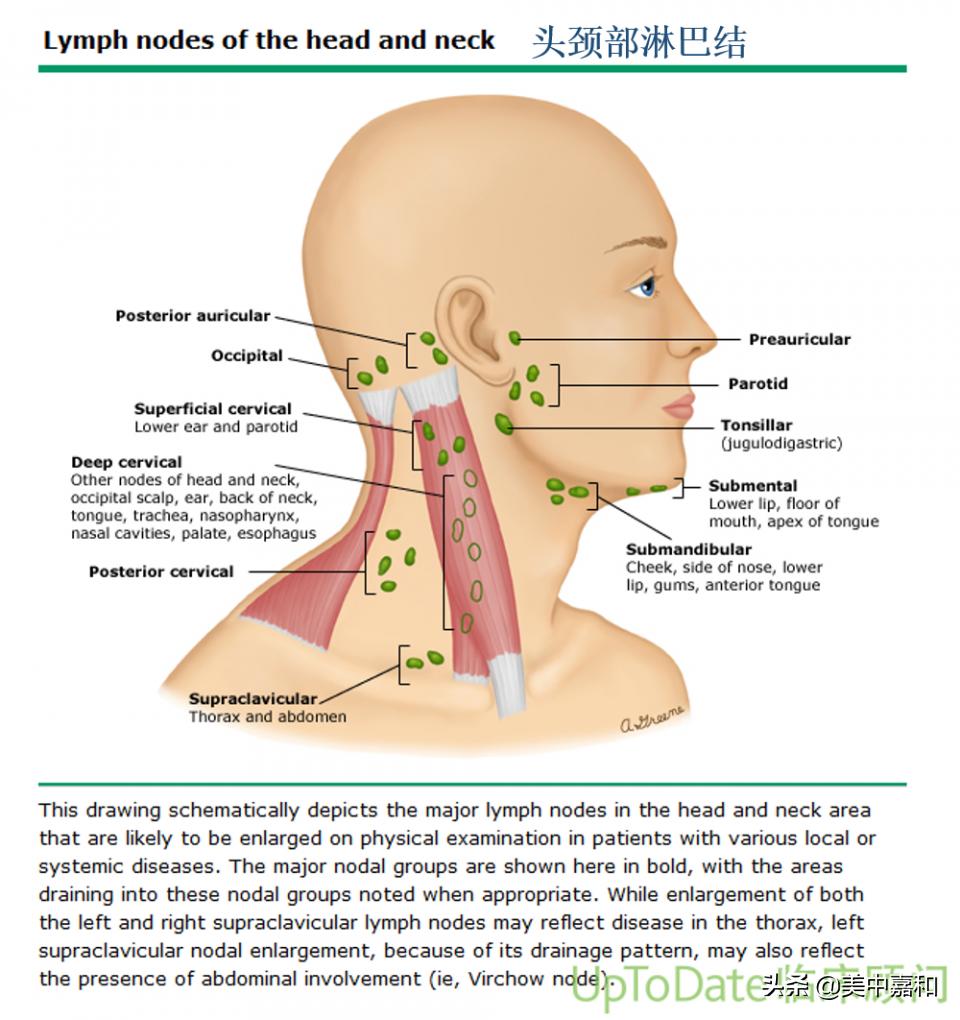 肢体慢性淋巴水肿属于哪种水肿,淋巴水肿了要怎么处理