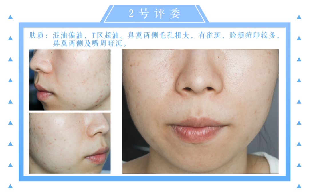 「Foundation101」遮瑕组在线battle!谁才是水煮蛋之王？（上）