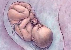 脐带绕颈胎儿会有危险吗,胎儿脐带绕颈需要剖腹吗