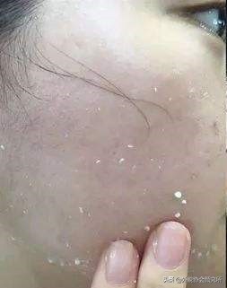 玻尿酸原液是补水还是保湿的,玻尿酸美容液是不是智商税