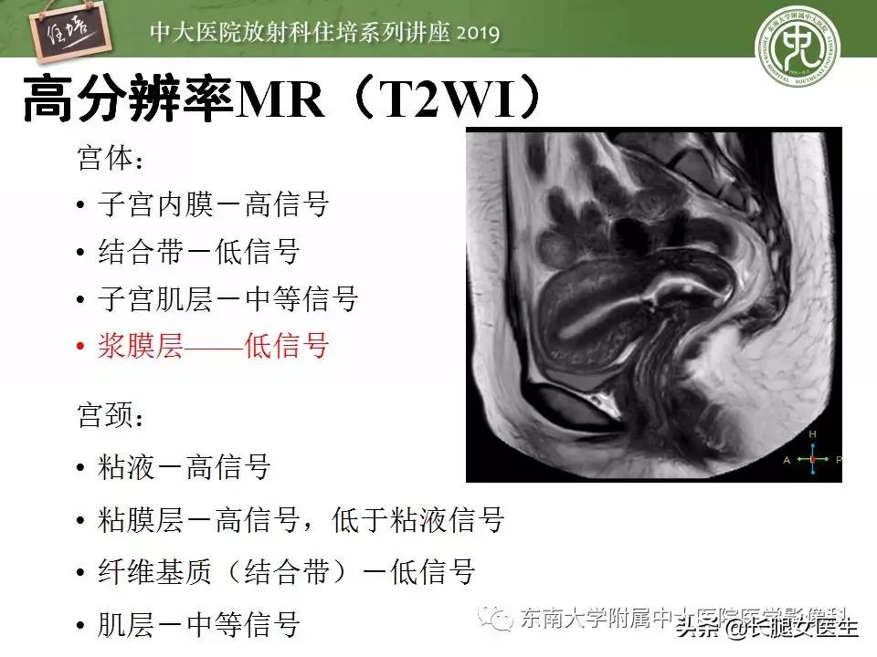 女性生殖子宫影像解剖及生理改变