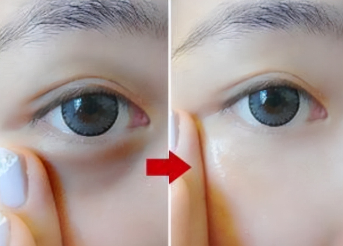 身边这5种“买得起”的老牌眼霜，别嫌弃是小牌，口碑不比大牌差