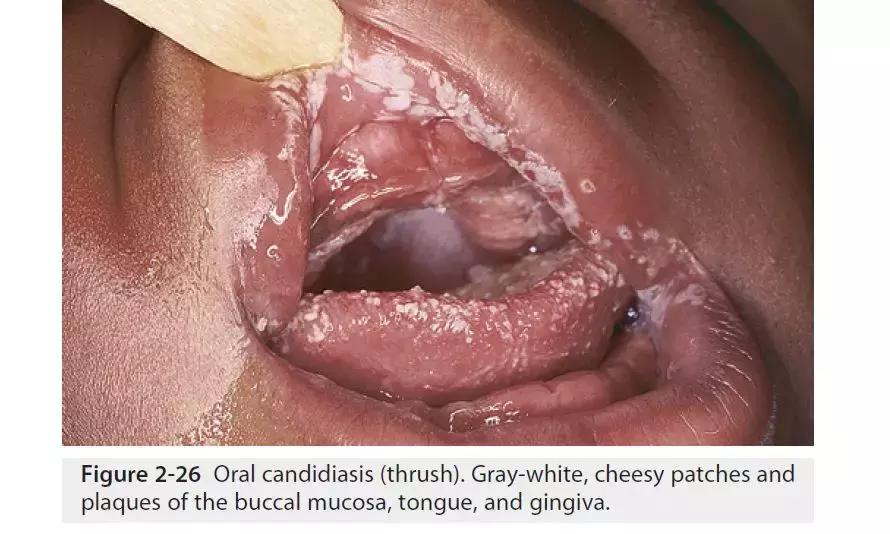 新生儿皮肤问题大全一览表,新生儿常见八大皮肤问题
