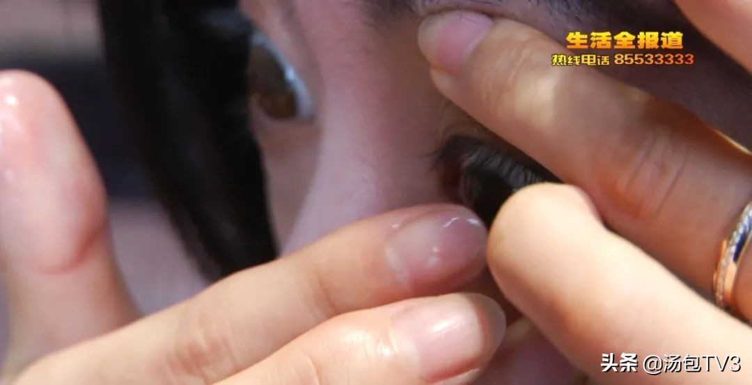 爱戴美瞳的人注意了美瞳美化了我们的眼睛但是也伤了我们的眼睛