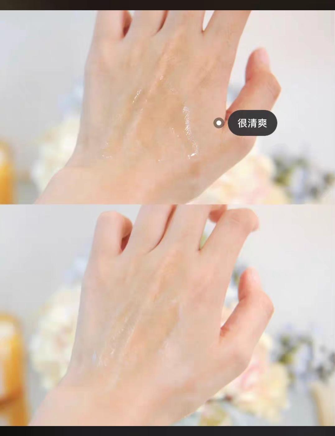 水杨酸刷酸烂脸后的真实经历,刷酸后脸长期泛红怎么办