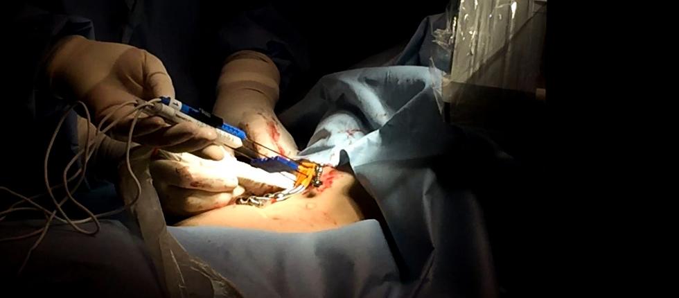 肝癌腹腔镜消融和ct消融哪个好,射频消融治疗肝癌的优缺点是什么