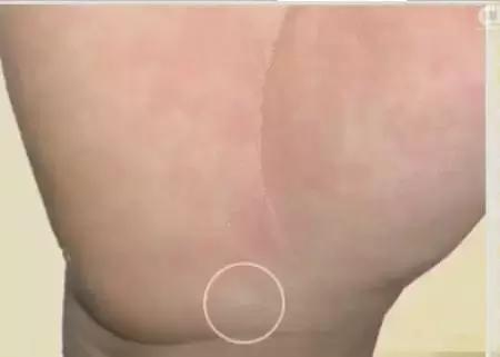 14种常见病的诊断方法,手诊10种常见病从手上就能看出来