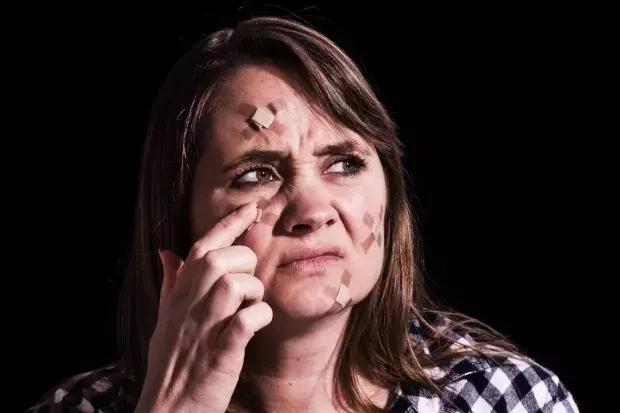 十年长痘史一直反复未治愈过,10年痘痘还能治疗吗