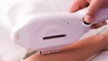 激光脱毛安全吗,头发激光脱毛安全吗