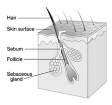 中国人为什么开始长痘痘了？
