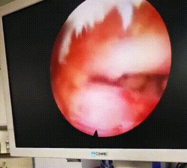 滑县人民医院最好医生,滑县人民医院卒中中心主任