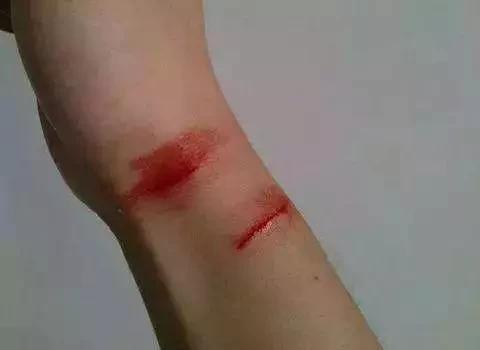 猫咪伸爪子误伤要惩罚吗,猫咪伸爪子抓我衣服是怎么回事