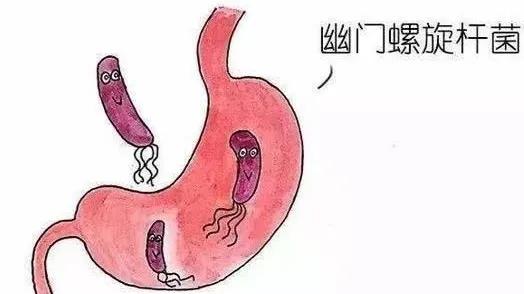 胃炎的饮食方面要注意什么,胃炎的饮食和注意事项