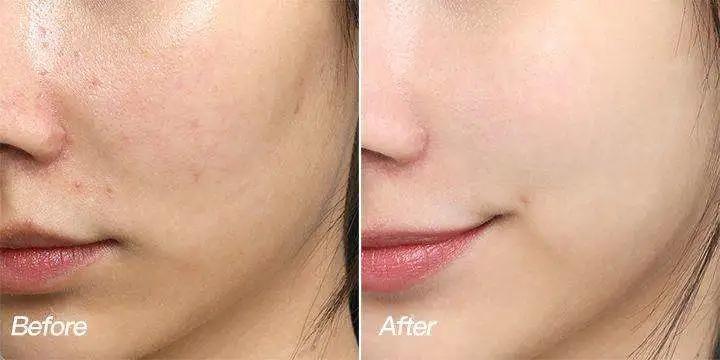 那些学化妆的女孩子后来怎么样了,学医美的女生怎么样