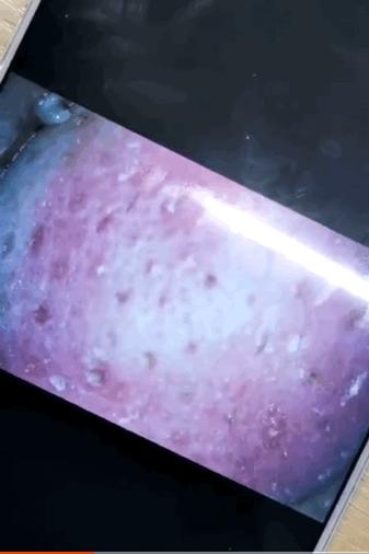 家用便携可视化祛黑头仪,金稻可视化吸黑头仪评测