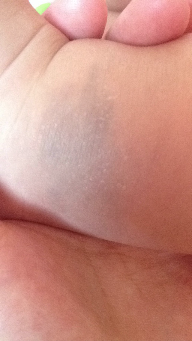 宝宝皮肤常见问题汇总:原因与对策妈妈要知道,孩子成长更健康