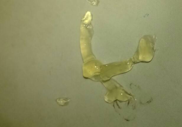 精子质量检测深度学习,精子质量检测怎么做