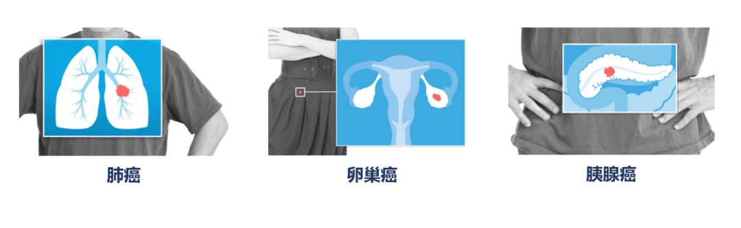 最新科研进展nk免疫细胞治疗癌症,抗癌药物组合物