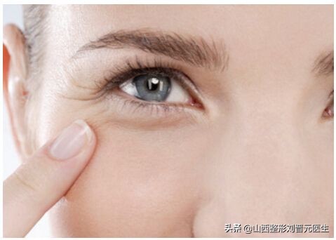 先改善细纹还是先修复抗衰,眼部显老怎么做抗衰