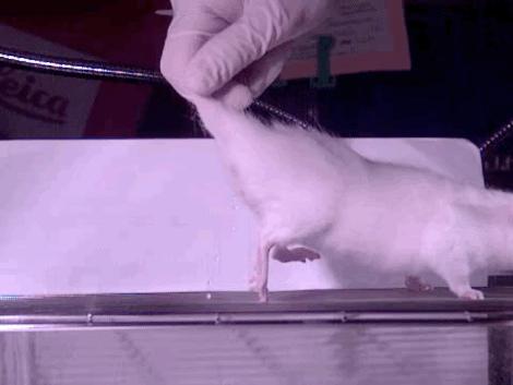 孩子膀胱容量130,儿童最大膀胱容量197正常吗