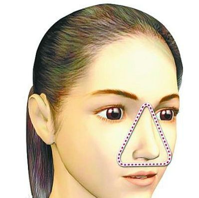 挤了痘痘一直不好,挤了很多次的痘痘还是没挤干净