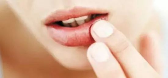 孕晚期嘴角长泡泡,孕期上火嘴里有泡泡应该怎么办