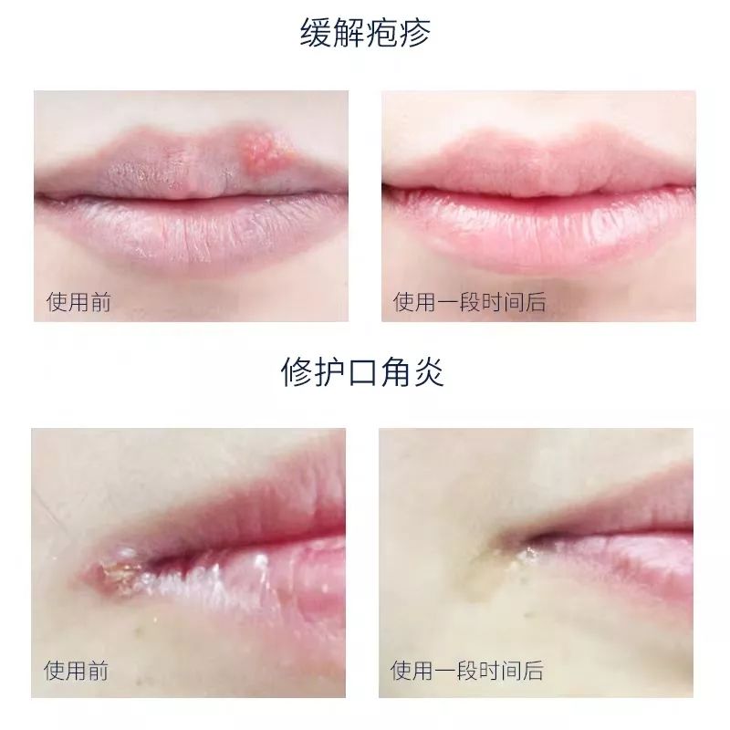 润唇膏测评前十,冬天嘴唇干裂用什么唇膏