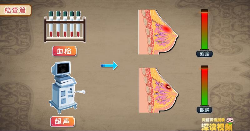 乳腺炎期间能通乳吗,非哺乳期乳腺炎要热敷还是冷敷