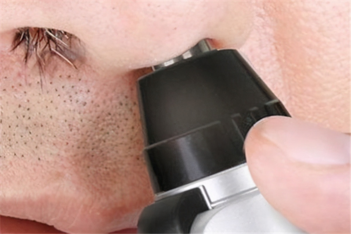 鼻毛太长会有影响吗,鼻毛太长可以拔掉么