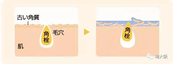 毛孔大爱出油还起皮怎么护肤,皮肤暗沉粗糙毛孔大修复对比