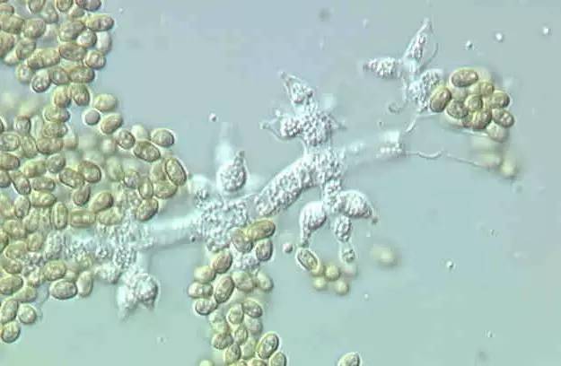 木霉菌到底是何方神圣？它是怎样防治病害的？
