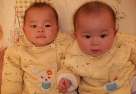 双胞胎两个爹亲子鉴定结果,双胞胎亲子鉴定一个不是亲生