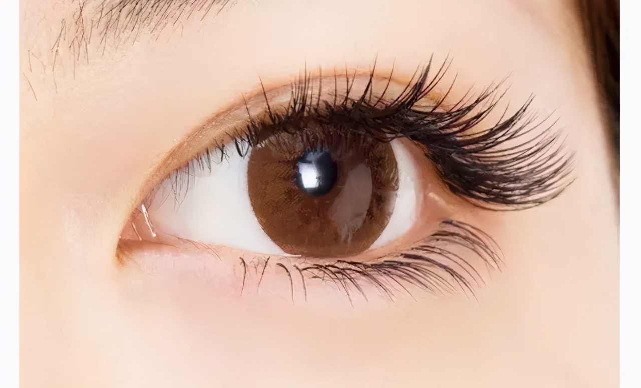 眼睑内翻倒睫治疗方法,老年人倒睫最快的治疗方法