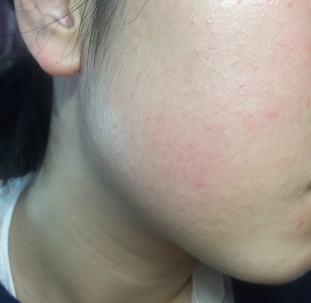 学生党水乳无印良品,无印良品水乳青春期选哪一款