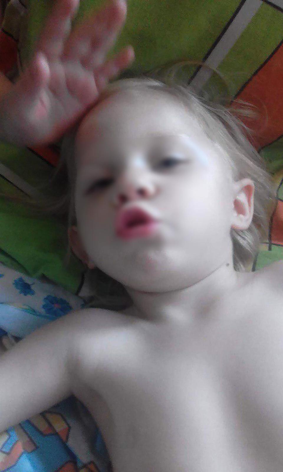 俄罗斯女孩出生时无肛门，医生一直误诊，她为此痛苦了三年