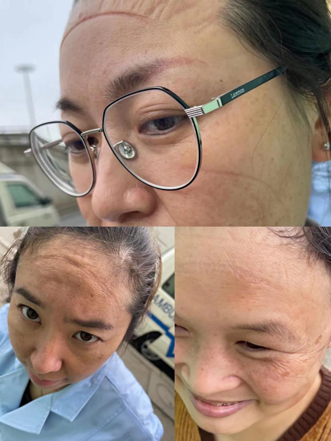 月圆日疫情来袭同战疫只争朝夕