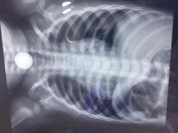 致孩子误吞这么多的异物差点丧命,婴儿误吞异物的紧急处理