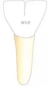 8岁宝宝牙齿长双排牙,1岁婴儿长双牙怎么办