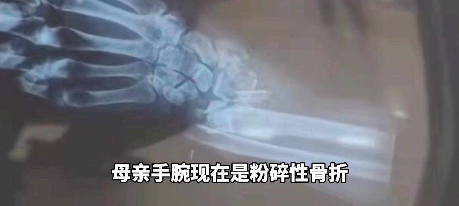 粉碎性腕骨骨折！辽宁一外卖小哥撞倒7旬教师，小伙看到老人伤情太重竟逃跑？