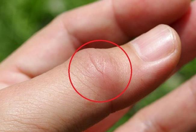 睡觉4个表现说明尿酸或超标,睡觉出现3种症状可能尿酸已超标