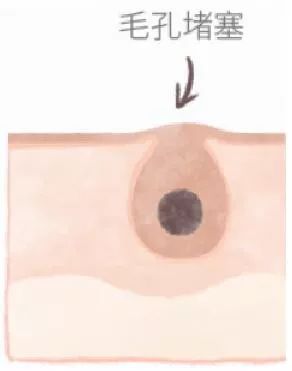 城野医生毛孔细致焕活精华水测评,城野医生毛孔收敛水使用步骤