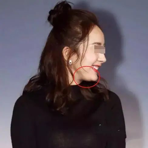 双下巴显脸大怎么改善,双下巴很明显但是不胖