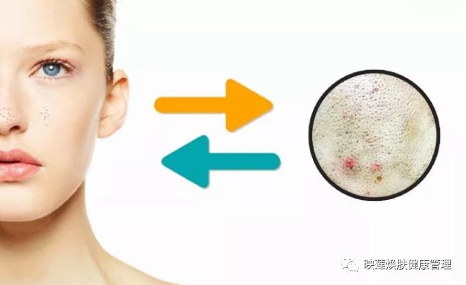 脸部皮肤严重缺水怎么调理,皮肤油光暗沉怎么办