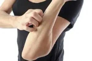 「十堰」痒痒痒！高发季节！竹溪人中招了吗？